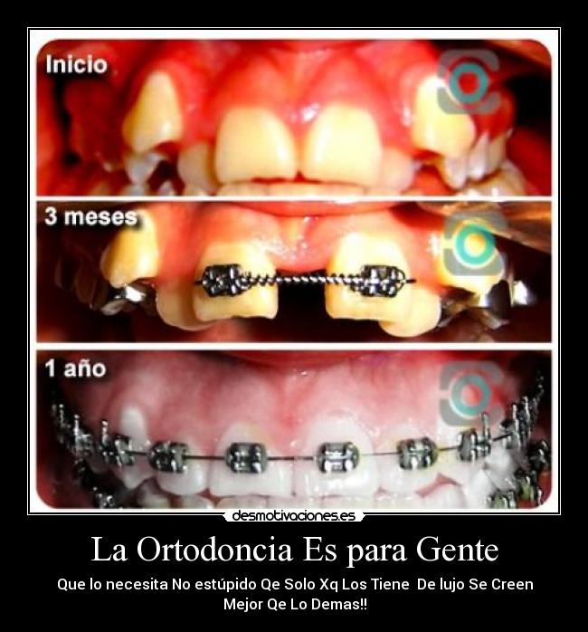La Ortodoncia Es para Gente - 