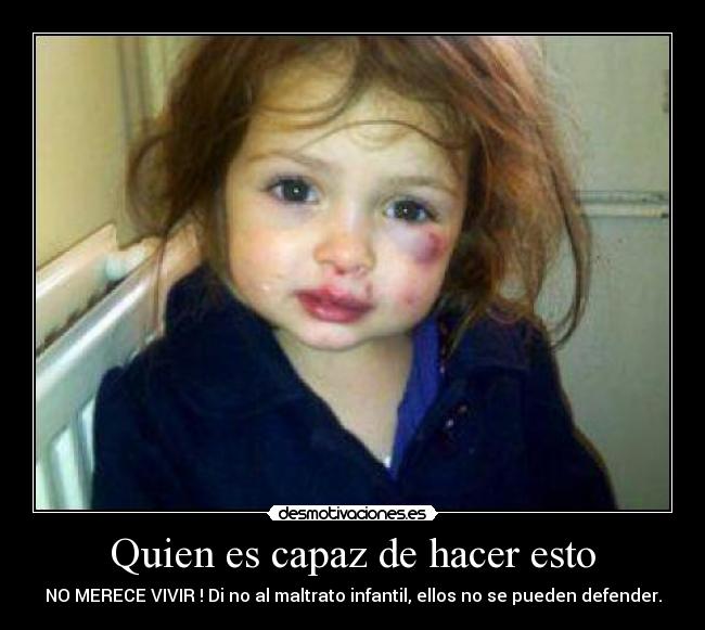 Quien es capaz de hacer esto - NO MERECE VIVIR ! Di no al maltrato infantil, ellos no se pueden defender.