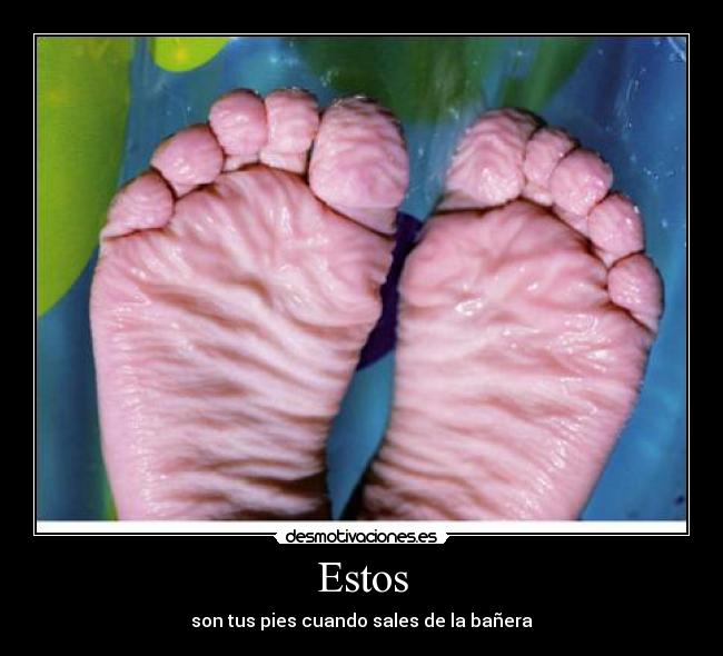 Estos - son tus pies cuando sales de la bañera