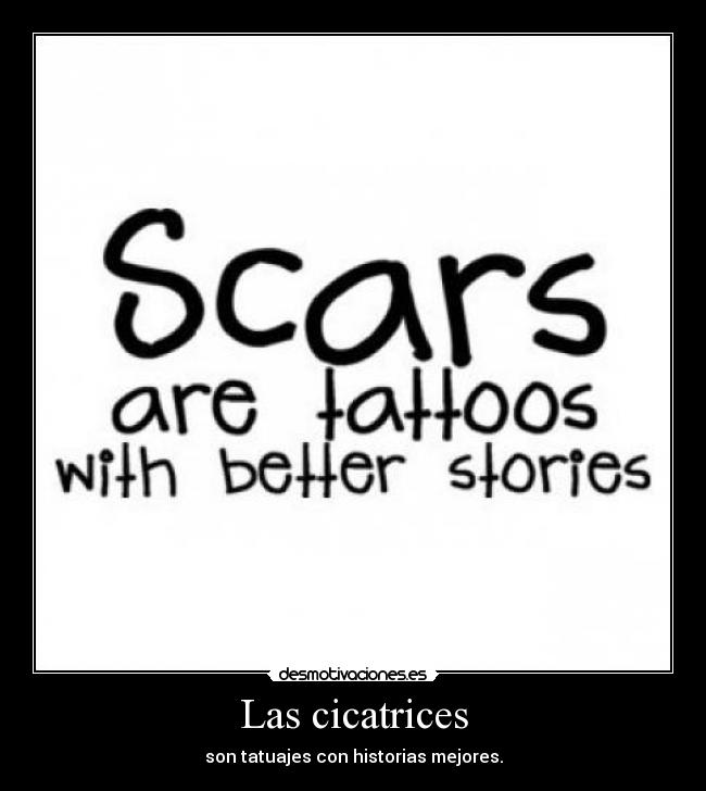 Las cicatrices -