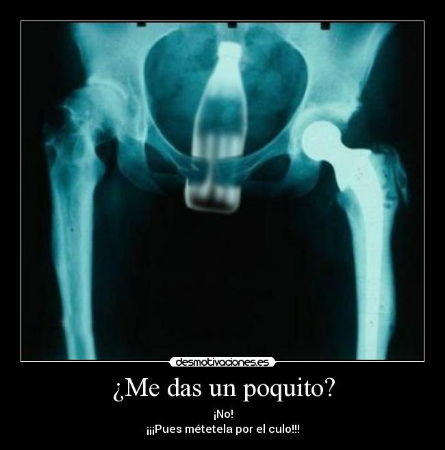 carteles fail radiografia poquito eskolaris humor coca cola desmotivaciones
