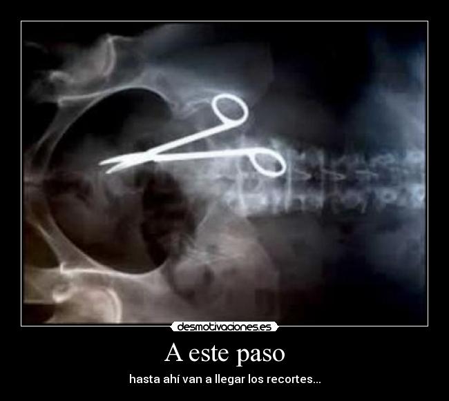 A este paso - hasta ahí van a llegar los recortes...