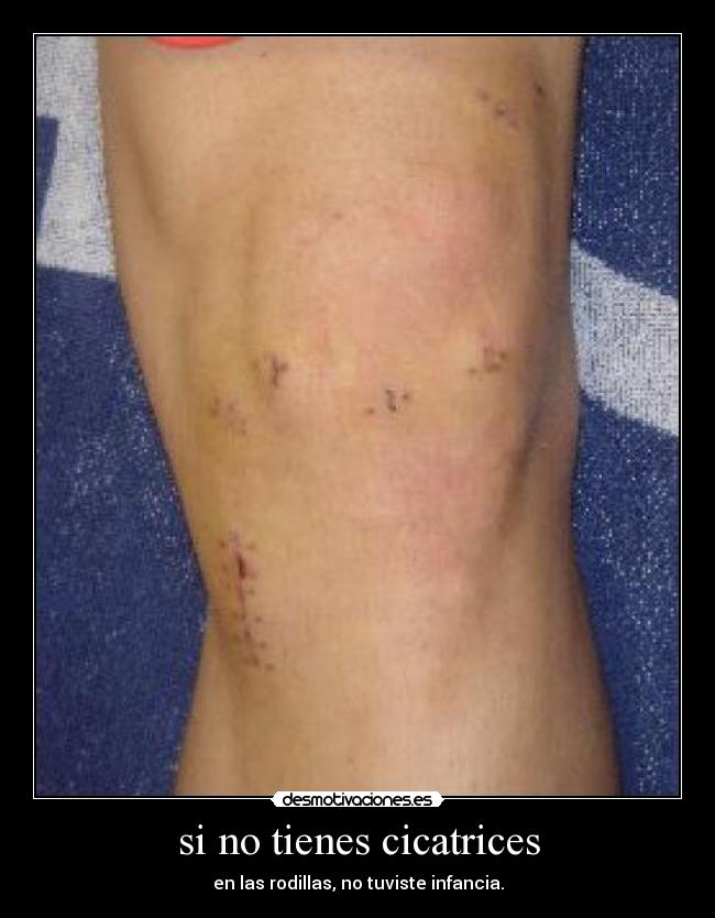 si no tienes cicatrices -