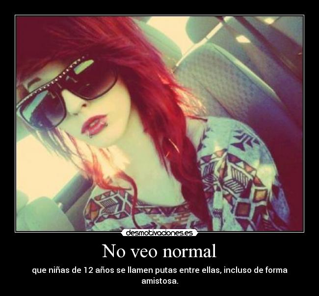 No veo normal - 