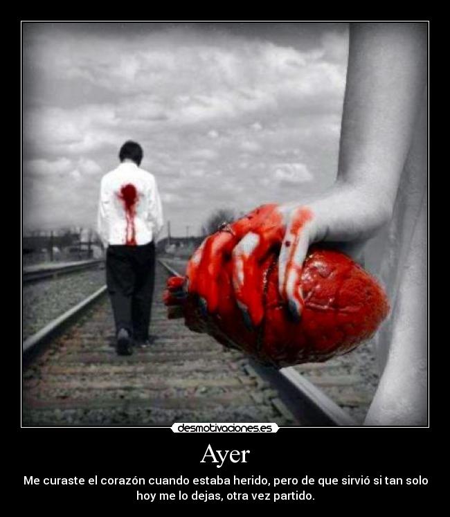 Ayer - Me curaste el corazón cuando estaba herido, pero de que sirvió si tan solo
hoy me lo dejas, otra vez partido.