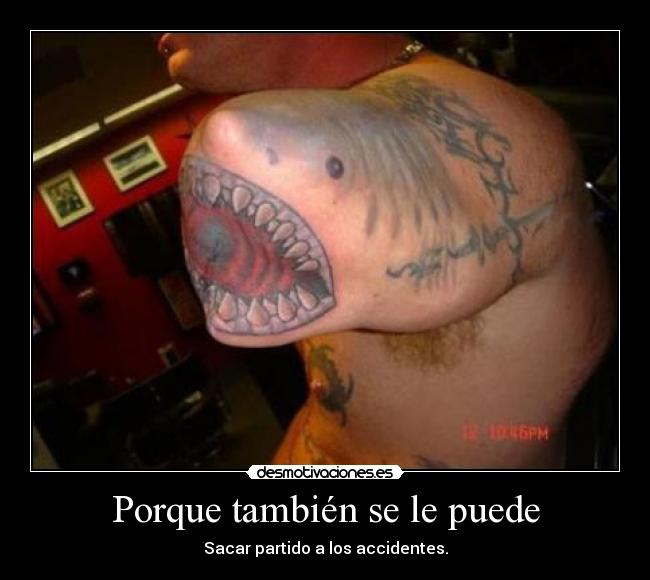 Porque también se le puede - Sacar partido a los accidentes.