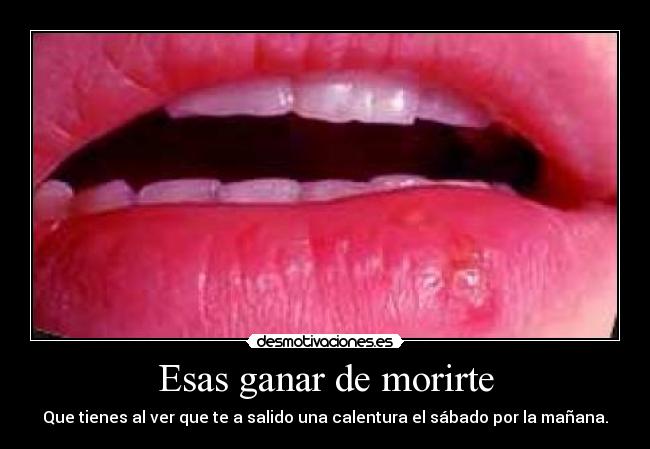 Esas ganar de morirte -