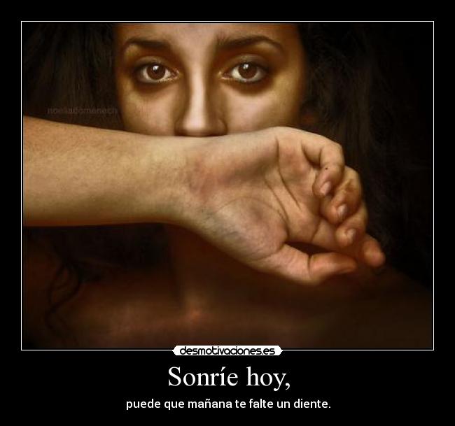 Sonríe hoy, - puede que mañana te falte un diente.