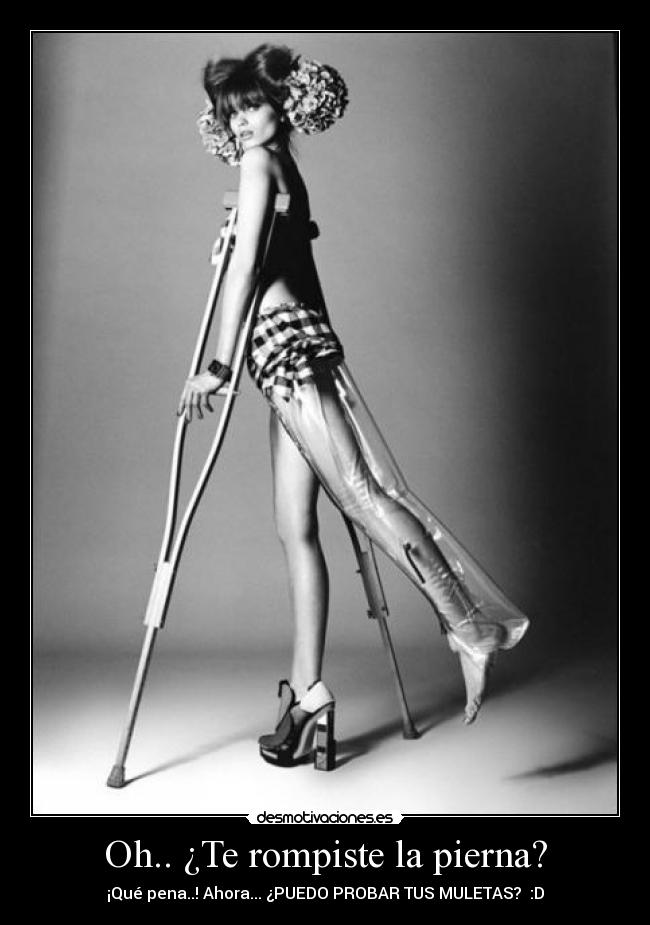 Oh.. ¿Te rompiste la pierna? -