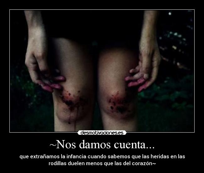 ~Nos damos cuenta... - que extrañamos la infancia cuando sabemos que las heridas en las
rodillas duelen menos que las del corazón~