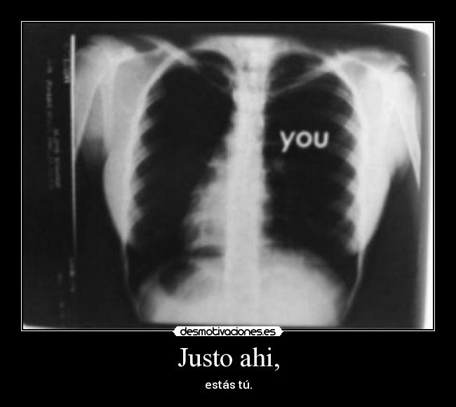 Justo ahi, - estás tú.