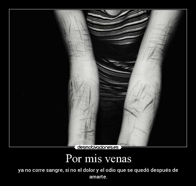 Por mis venas - ya no corre sangre, si no el dolor y el odio que se quedó después de amarte.