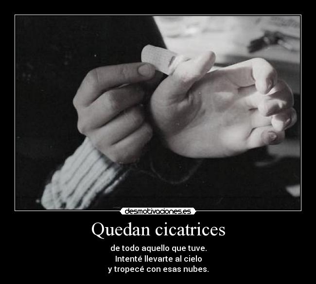 Quedan cicatrices - 