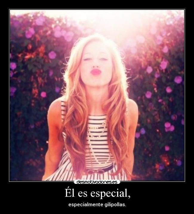 Él es especial, -