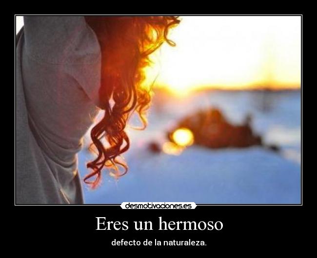 Eres un hermoso - defecto de la naturaleza.