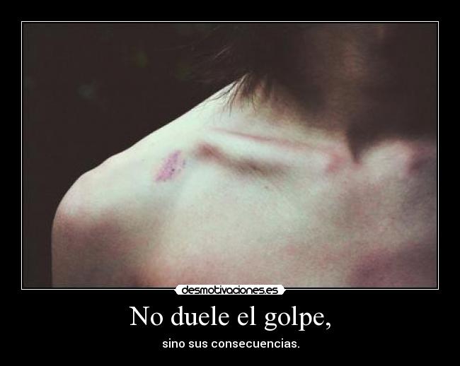 No duele el golpe, -