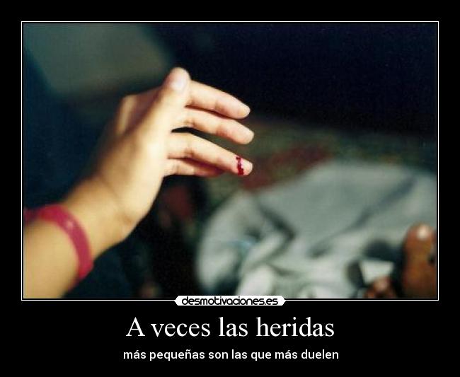 A veces las heridas -