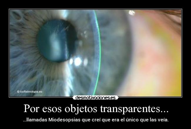 carteles miodesopsias desmotivaciones