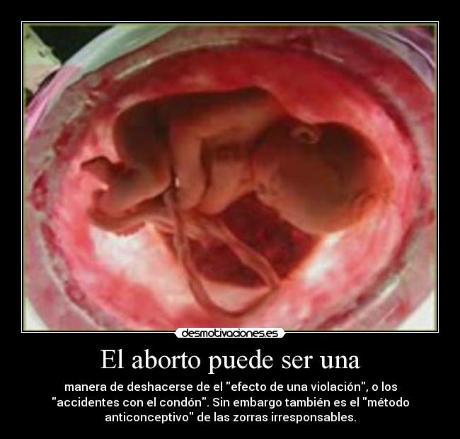 El aborto puede ser una - manera de deshacerse de el efecto de una violación, o los
accidentes con el condón. Sin embargo también es el método
anticonceptivo de las zorras irresponsables.