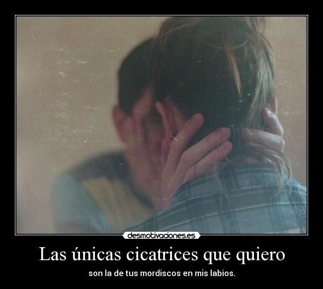 Las únicas cicatrices que quiero -