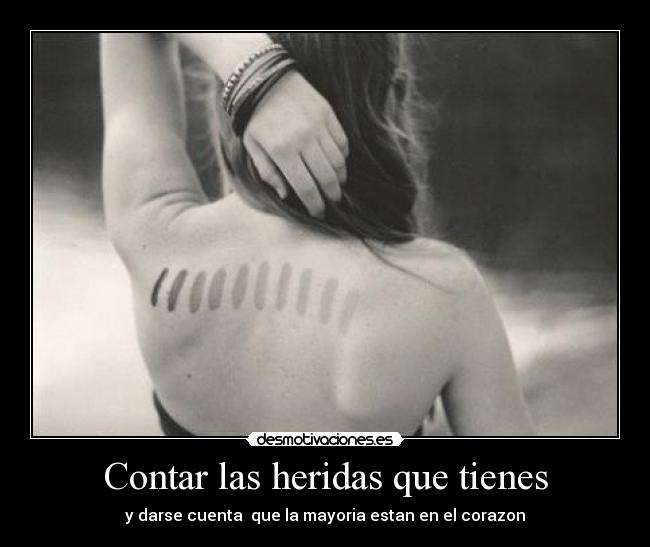 Contar las heridas que tienes - y darse cuenta que la mayoria estan en el corazon