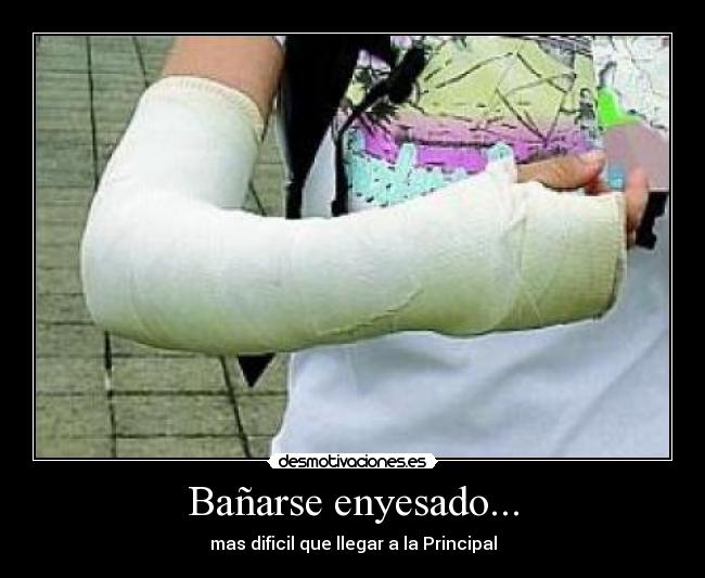 Bañarse enyesado... - mas dificil que llegar a la Principal