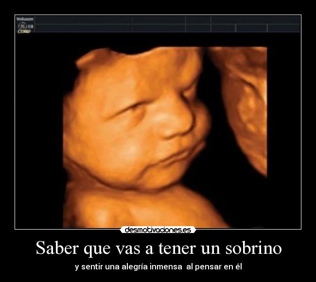 Saber que vas a tener un sobrino - 