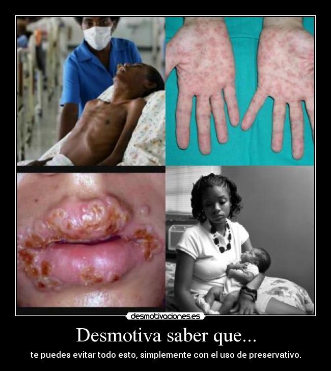 Desmotiva saber que... - te puedes evitar todo esto, simplemente con el uso de preservativo.