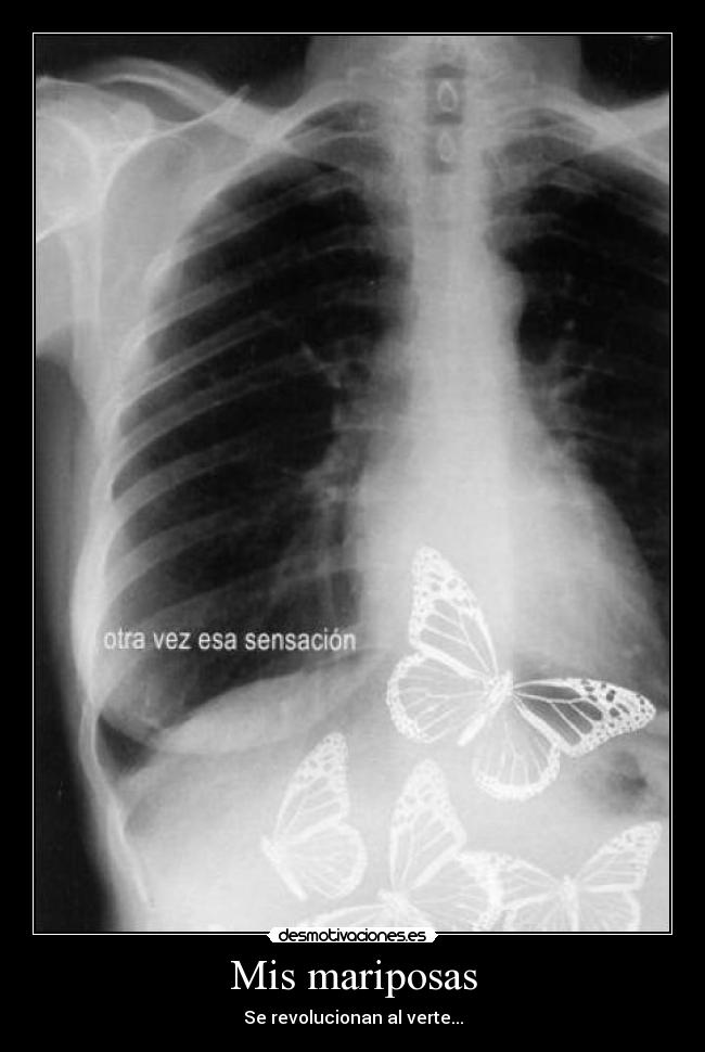 Mis mariposas - Se revolucionan al verte...