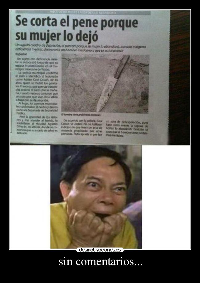 sin comentarios... -