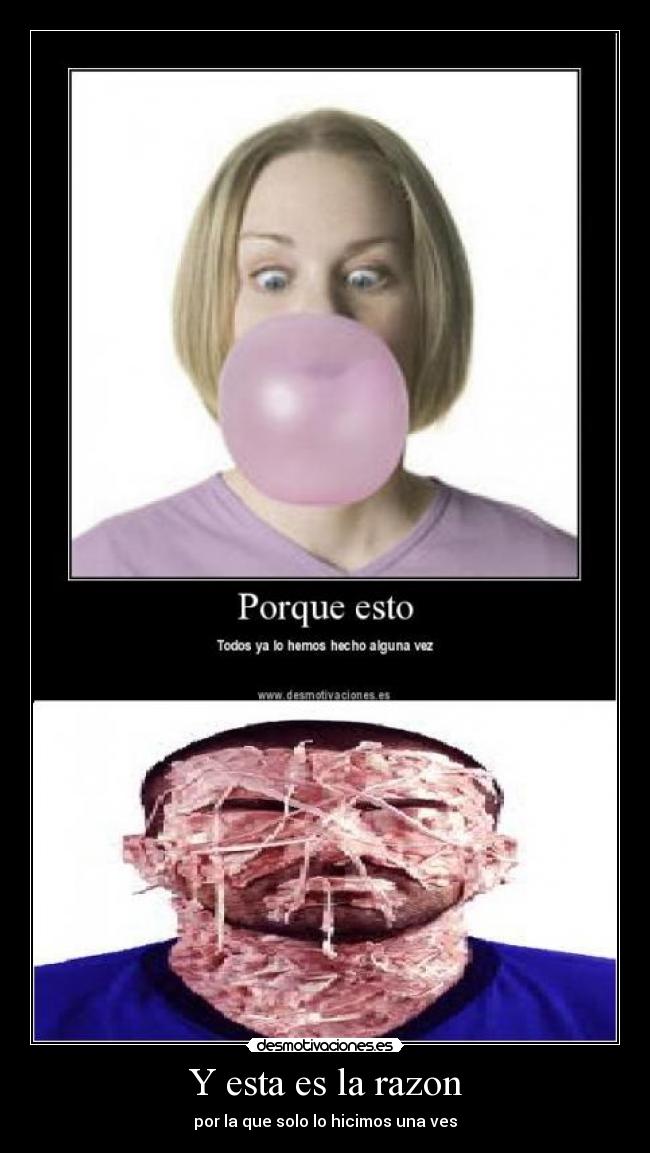 Y esta es la razon -