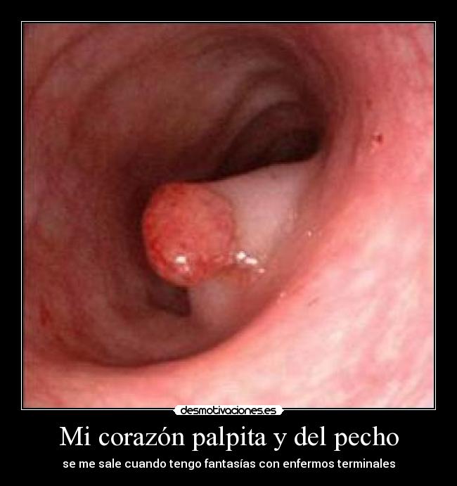 Mi corazón palpita y del pecho -