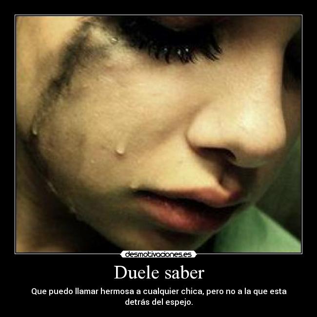 Duele saber -