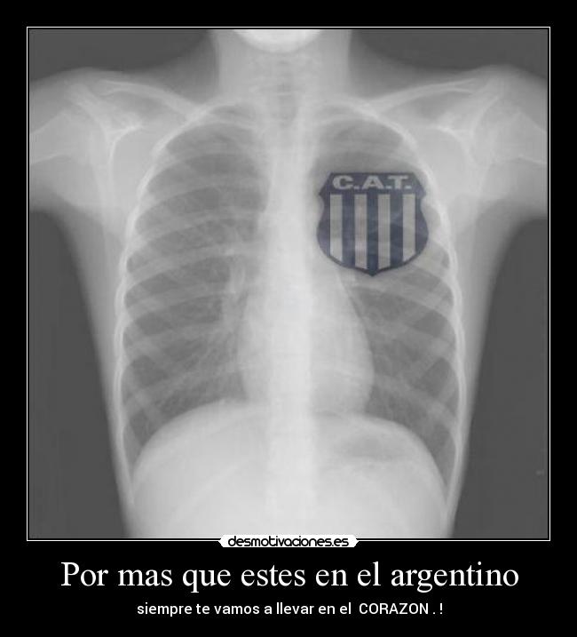 Por mas que estes en el argentino - siempre te vamos a llevar en el  CORAZON . !