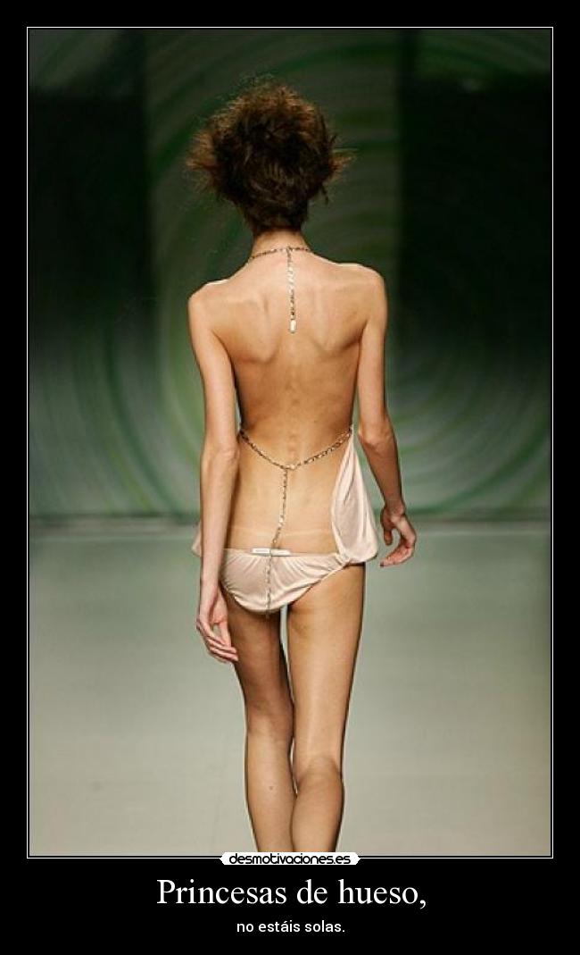 Princesas de hueso, -