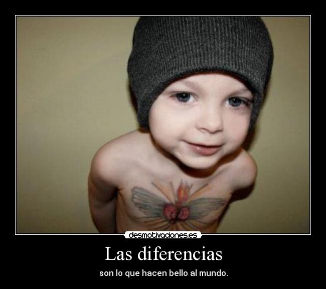 Las diferencias -