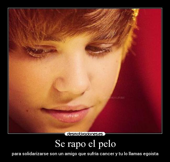 Se rapo el pelo - para solidarizarse son un amigo que sufría cancer y tu lo llamas egoista