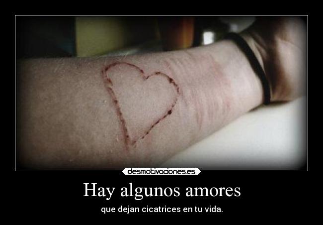 Hay algunos amores - que dejan cicatrices en tu vida.
