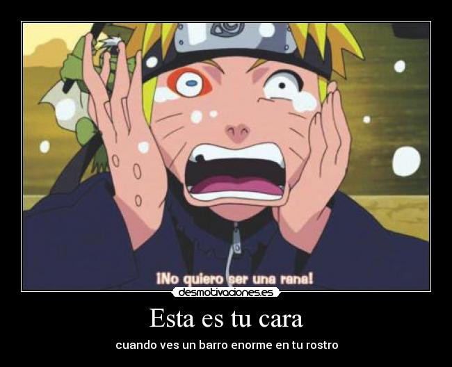 Esta es tu cara - cuando ves un barro enorme en tu rostro