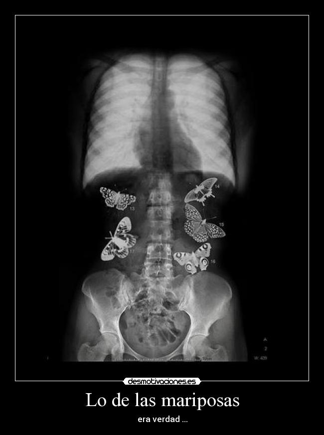 Lo de las mariposas - 