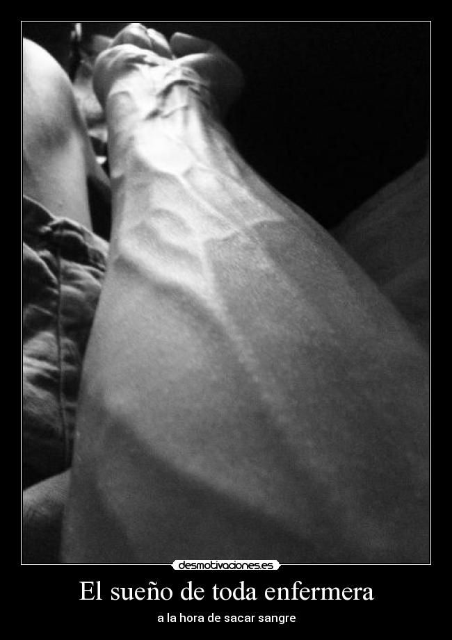 El sueño de toda enfermera - 