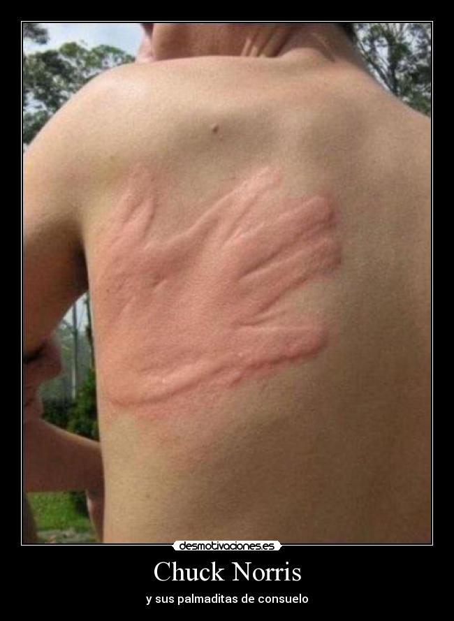 Chuck Norris -