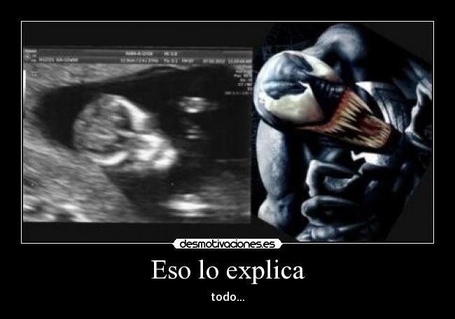 Eso lo explica - todo...