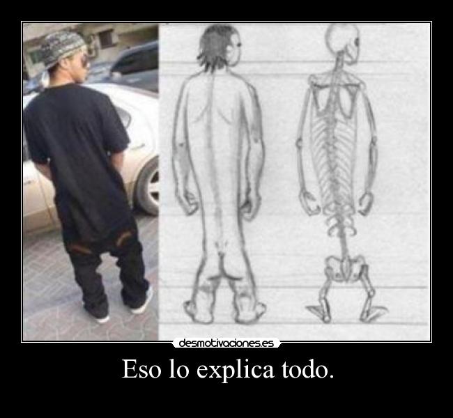 Eso lo explica todo. -