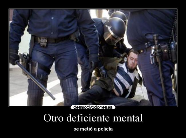 Otro deficiente mental -