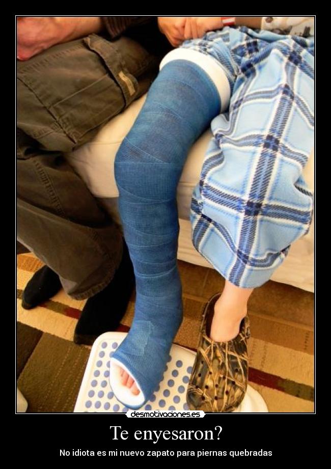 Te enyesaron? - No idiota es mi nuevo zapato para piernas quebradas