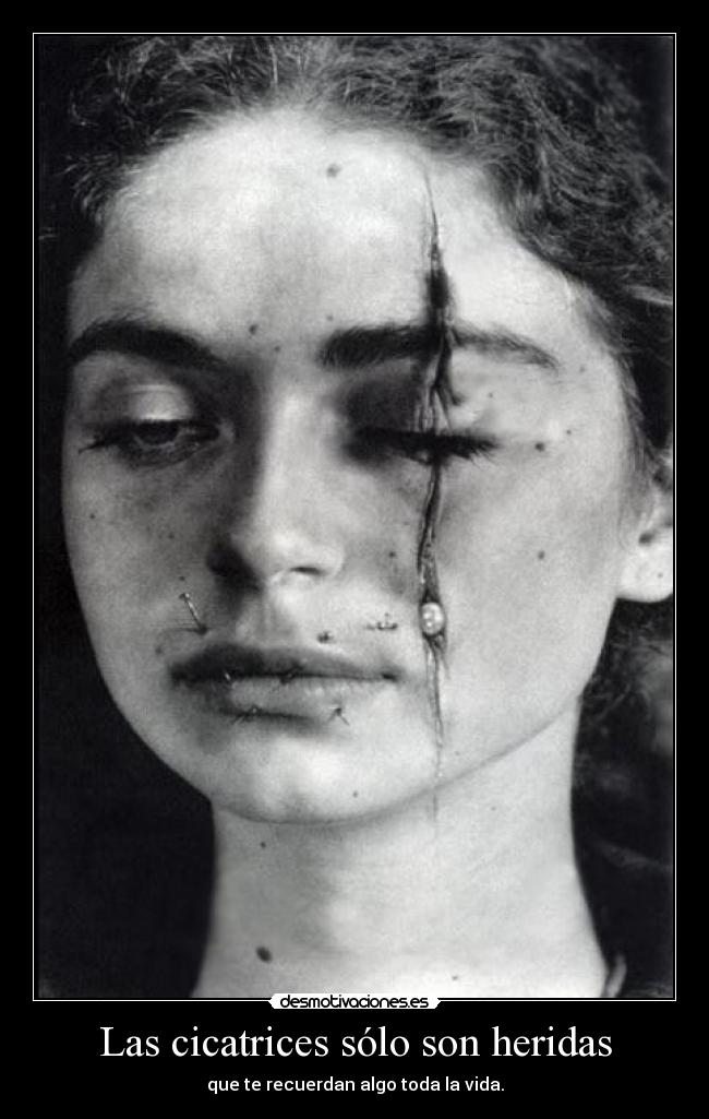 Las cicatrices sólo son heridas - que te recuerdan algo toda la vida.