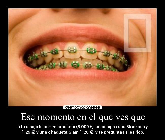 Ese momento en el que ves que - a tu amigo le ponen brackets (3.000 €), se compra una Blackberry
(129 €) y una chaqueta Slam (120 €), y te preguntas si es rico.