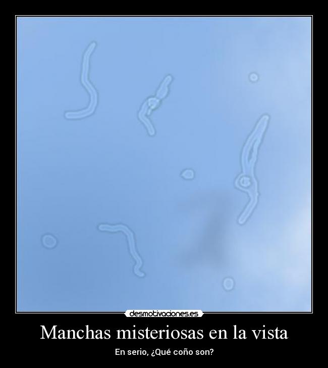 Manchas misteriosas en la vista - En serio, ¿Qué coño son?