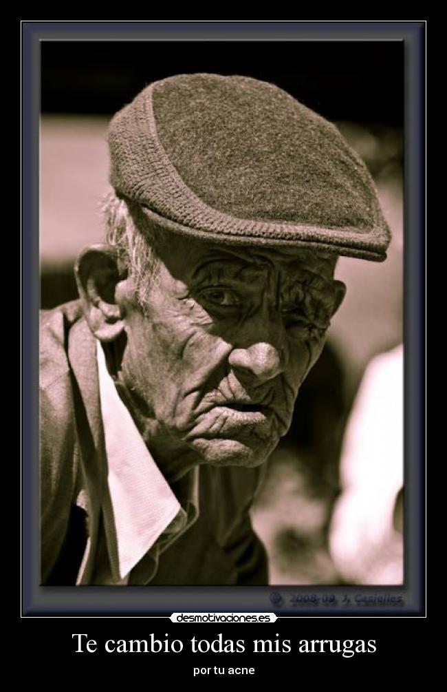 Te cambio todas mis arrugas - por tu acne